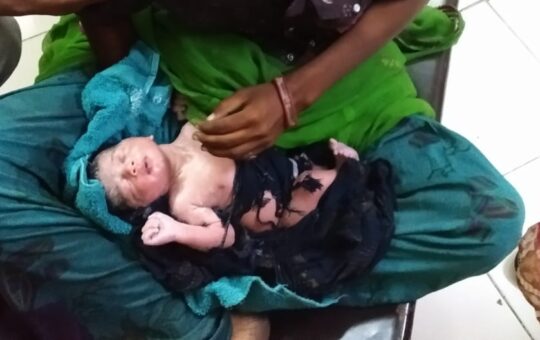 Mumbai- Tohili Bano (22), a pregnant woman who was traveling from Jodhpur to Mumbai, gave birth to a healthy baby boy at the emergency medical room jointly run by Apex Hospital and Western Railway at Borivali station. Doctors said that this is the second such delivery in Mumbai. EMR Head and Senior Physician of Apex Hospital Dr. Umesh Gaikwad said, “Eight-month pregnant woman was coming from Jodhpur to Mumbai for delivery purposes. Her husband was also with her. But after crossing the Virar station, his stomach started churning. After the woman started vomiting, her husband told the employee working in the canteen. Realizing the seriousness of the situation, the security personnel on duty in the said coach informed the Borivali station. Then the team of Borivali Railway Police Station Senior Police Inspector Anil Kadam and Police Sub-Inspector Jayashree Mughalgir with the help of RPF and other security guards brought the woman to the medical room of Apex Hospital at platform number 3 of Borivali station."  At this time Dr. Umesh Gaikwad, Dr. Lakhichand Prajapati, Dr. Pankaj Rai, nurses Rekha Parmar and Savita Chaudhary delivered the woman successfully. She gave birth to a healthy and fit baby boy. The health of the baby and mother is good and they have been sent to Shatabdi Hospital. Apex Hospital and Western Railway jointly have a hospital at platform No. 3 which provides accident treatment, medical check-ups, and other essential medical services. Apex Hospital Group has been implementing this initiative with Western Railway for the last 4 years as a social commitment. Through this initiative, medical facilities are being provided to thousands of passengers at a low cost. GRP Kailas Shahane, Sushant Shinde, Devendra Shinde, Sagar Nagtilak Snhel Gawde, Home Guard Rani Borule, Siddhesh Kadam, Police Constable Jotiram Khote and Borivali Station Master Bharatbhushan Kakera and Station Superintendent Razak Shaikh were there for the safe delivery of the woman after 45 minutes after starting labor pain in Virar station.